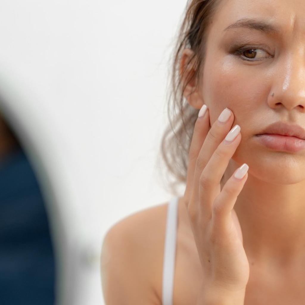 Dry & Dehydrated Skin